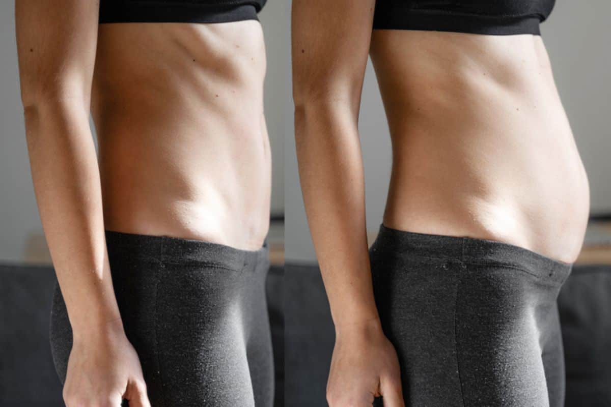 How long does diastasis recti take to improve Westcliff-on-Sea?
