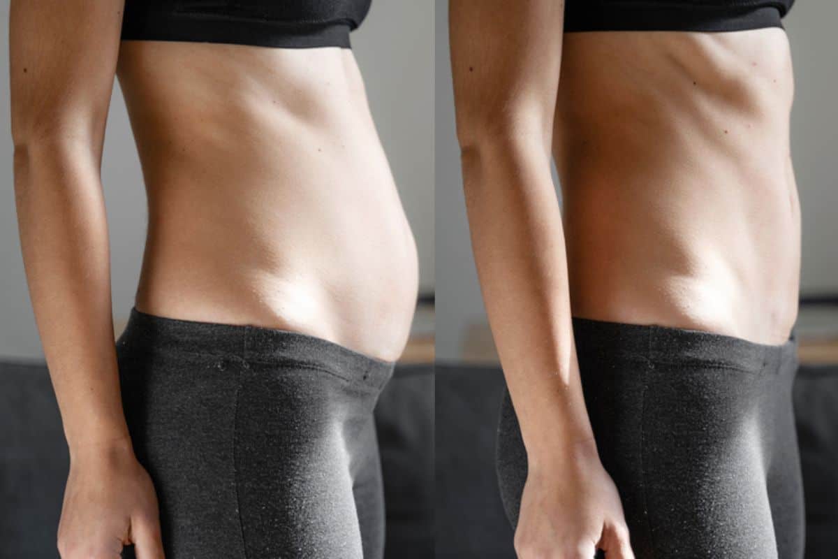 Post-Pregnancy: What Happens to Your Abdominal Muscles After Birth Westcliff-on-Sea