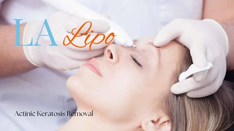 Woman receiving Actinic Keratosis Removal Treatment Westcliff-on-Sea