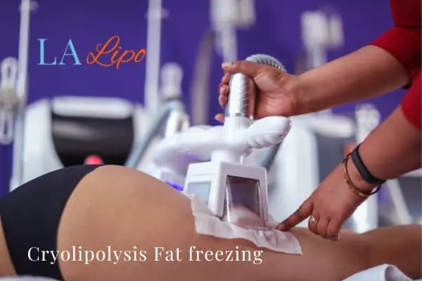 women getting fat freezing Westcliff-on-Sea