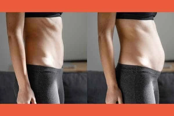 LA-EMS Body Sculpting results Westcliff-on-Sea