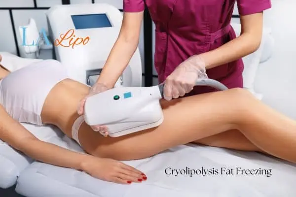 Woman receiving coolsculpting Westcliff-on-Sea treatment on her thighs