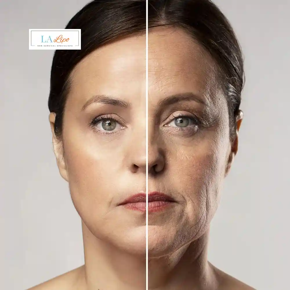 How Can You Tell If Non-Surgical Skin Tightening Is Right for You Westcliff-on-Sea?