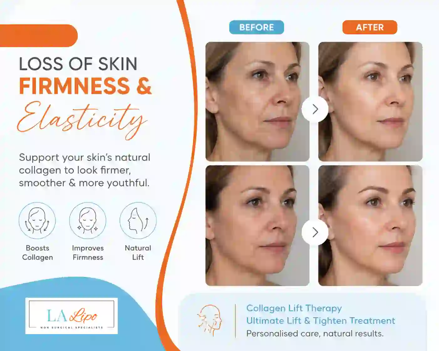 Sign #7: Loss of Skin Firmness and Elasticity Westcliff-on-Sea
